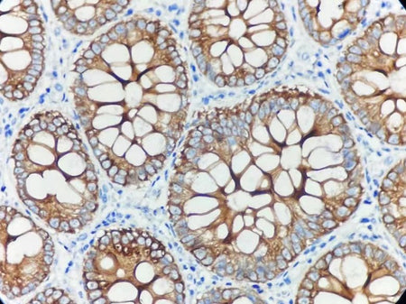 Marquage immunohistochimique anti-CK19 — Dartmon