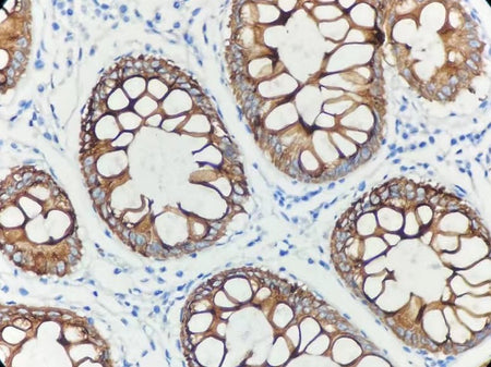 Marquage immunohistochimique anti-CK20 — Dartmon