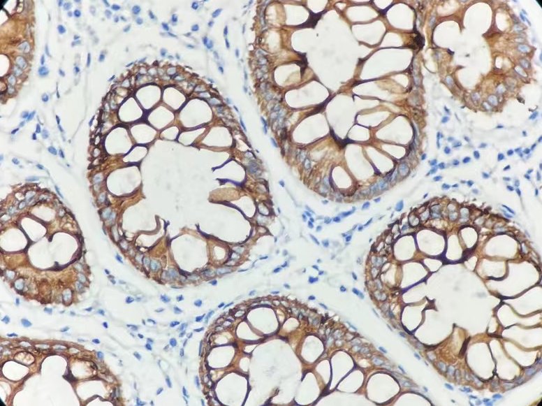 Marquage immunohistochimique anti-CK20 — Dartmon