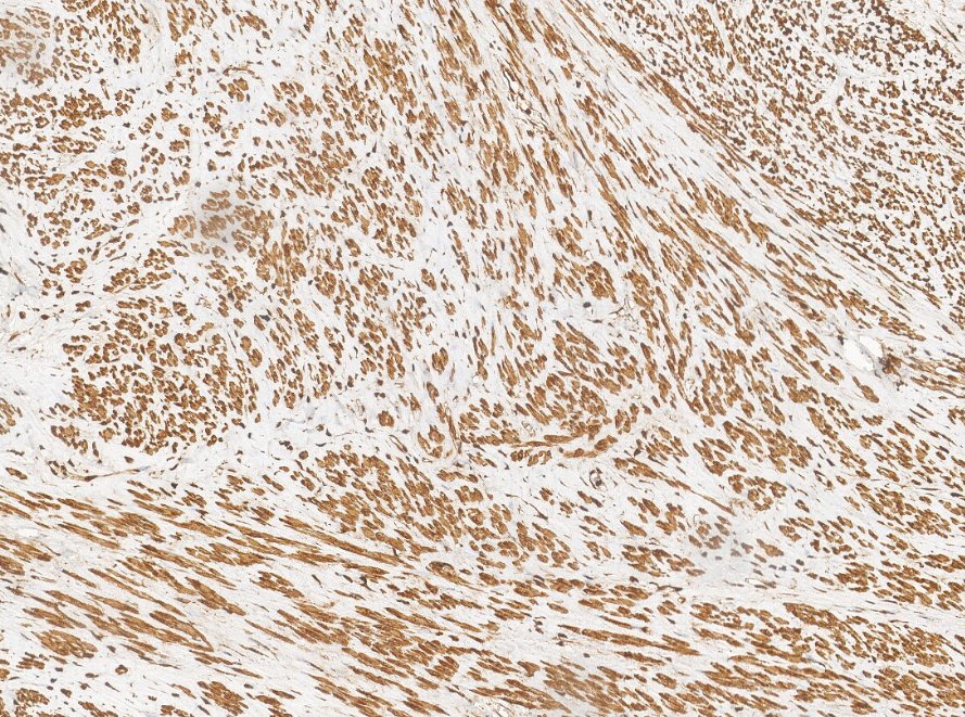 Marquage immunohistochimique anti-DES — Dartmon