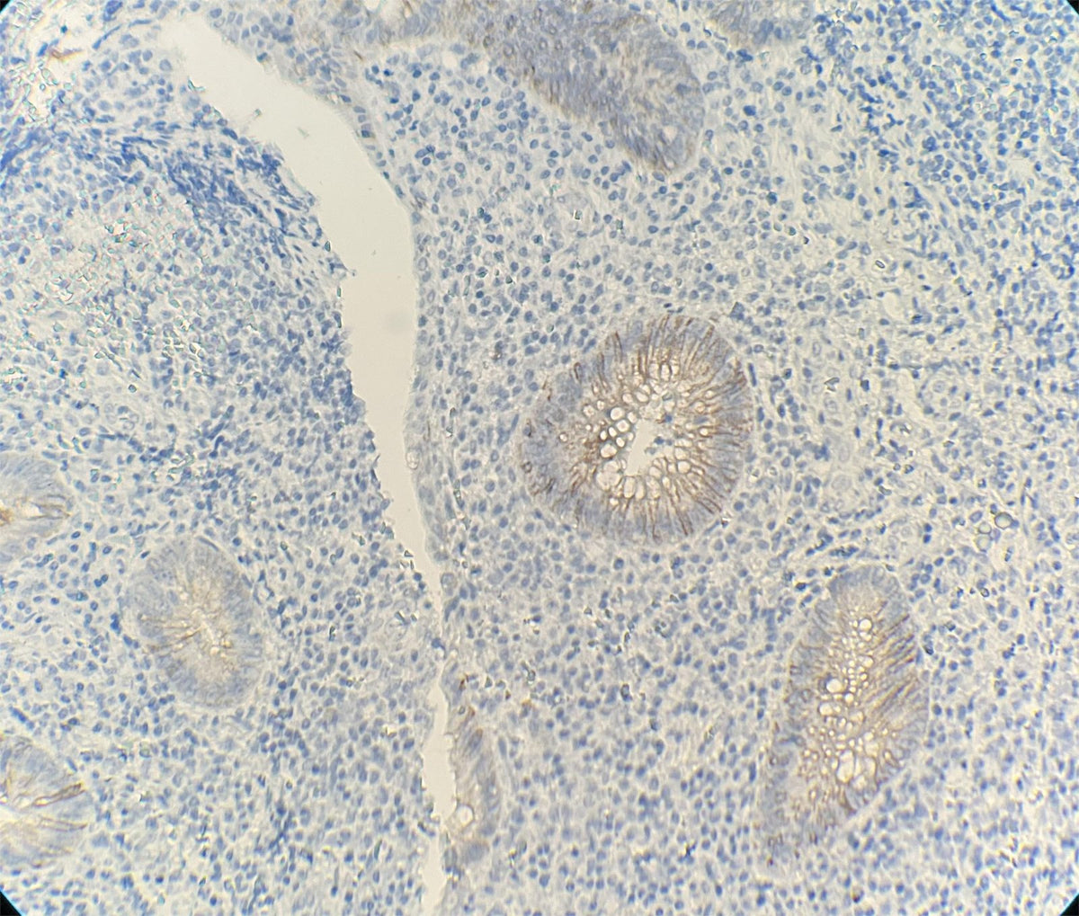 Marquage immunohistochimique anti-DOG1 — Dartmon