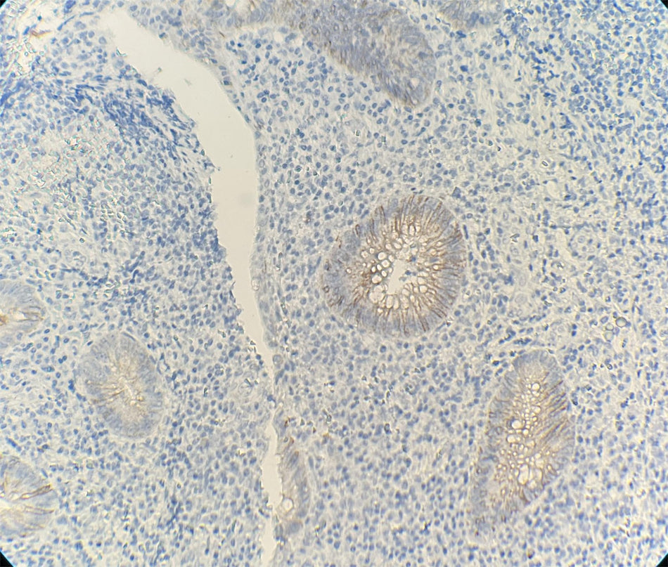 Marquage immunohistochimique anti-DOG1 — Dartmon