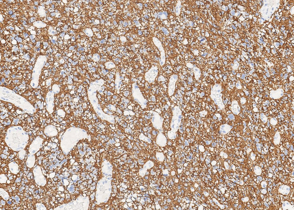 Marquage immunohistochimique anti-GFAP — Dartmon