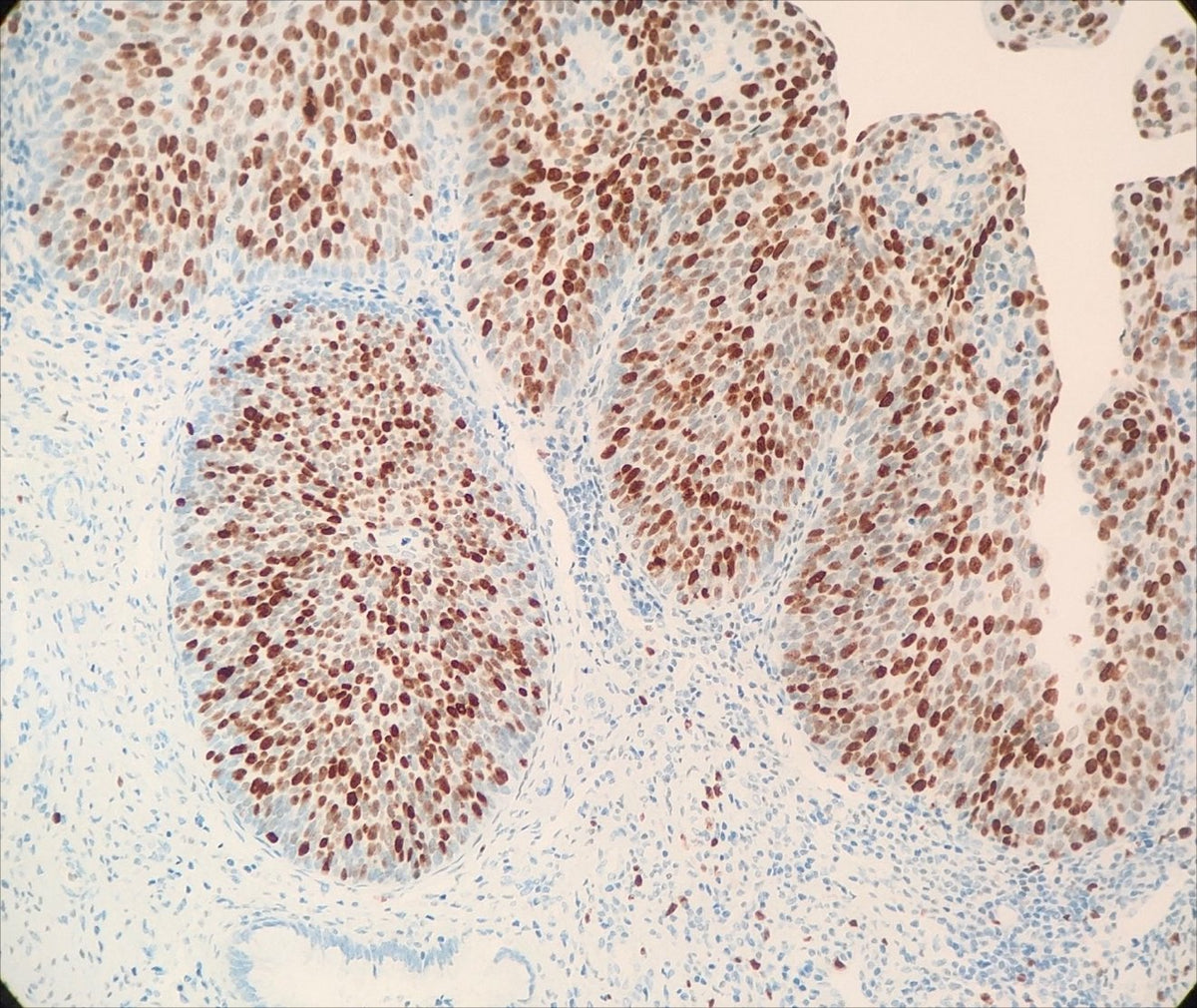 Marquage immunohistochimique anti-Ki-67 — Dartmon