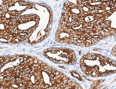 Marquage immunohistochimique anti-PSA — Dartmon