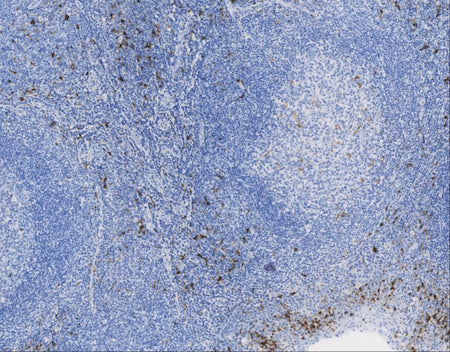 Marquage immunohistochimique anti-S100 — Dartmon