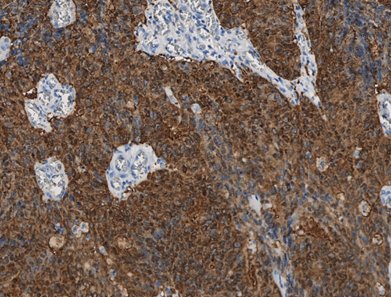 Marquage immunohistochimique anti-VIL1 — Dartmon