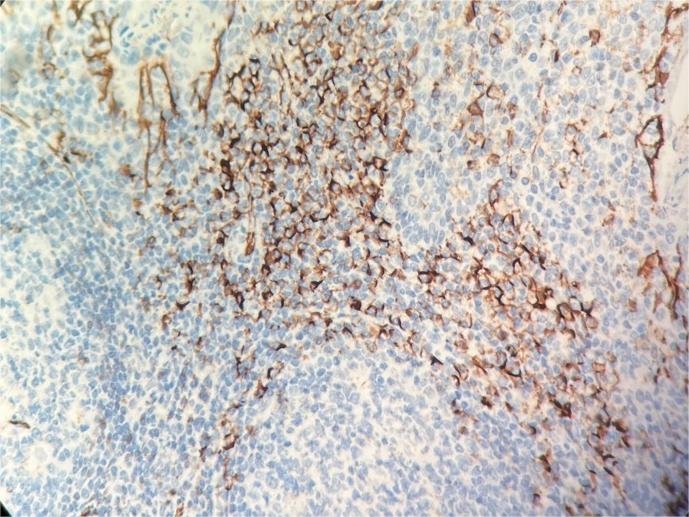 Marquage immunohistochimique anti-CD31 — Dartmon