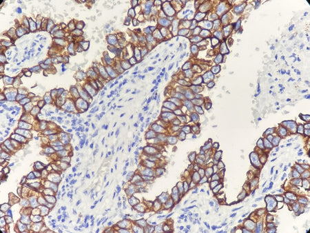 Marquage immunohistochimique anti-CK7 — Dartmon