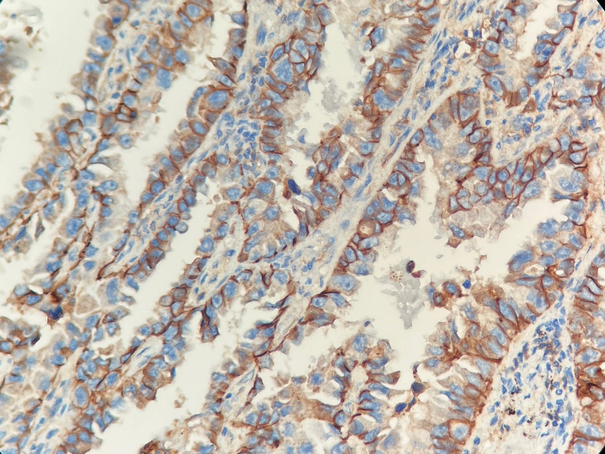 Marquage immunohistochimique anti-E-Cad — Dartmon