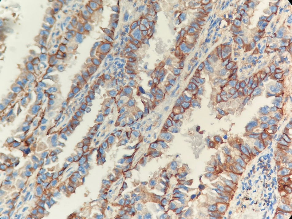 Marquage immunohistochimique anti-E-Cad — Dartmon