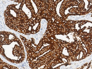 Marquage immunohistochimique anti-PSMA — Dartmon