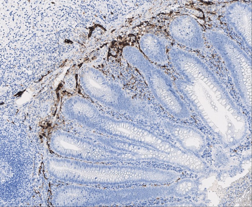 Marquage immunohistochimique anti-Calretinin — Dartmon