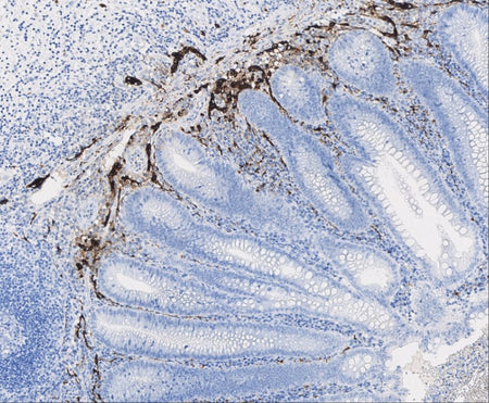 Marquage immunohistochimique anti-Calretinin — Dartmon