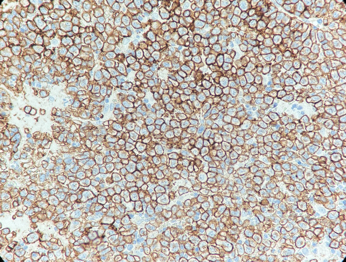 Marquage immunohistochimique anti-CD138 — Dartmon