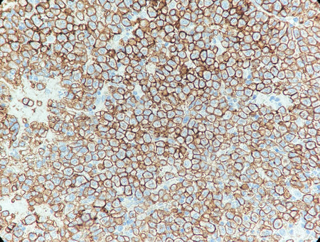 Marquage immunohistochimique anti-CD138 — Dartmon