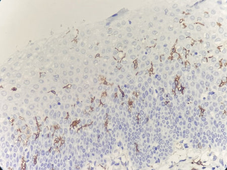 Marquage immunohistochimique anti-CD1a — Dartmon