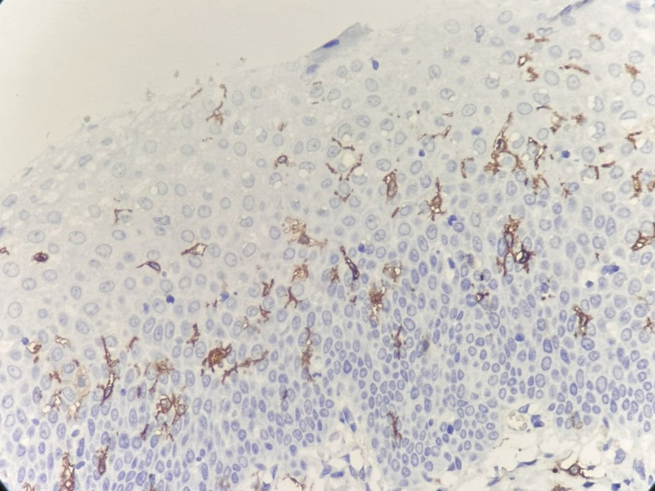 Marquage immunohistochimique anti-CD1a — Dartmon