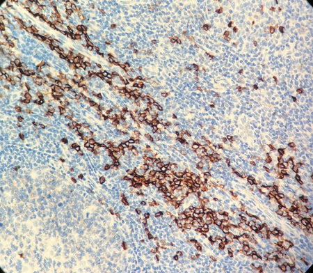 Marquage immunohistochimique anti-CD38 — Dartmon
