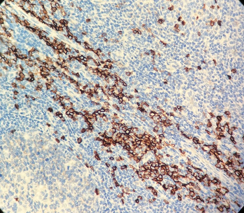 Marquage immunohistochimique anti-CD38 — Dartmon