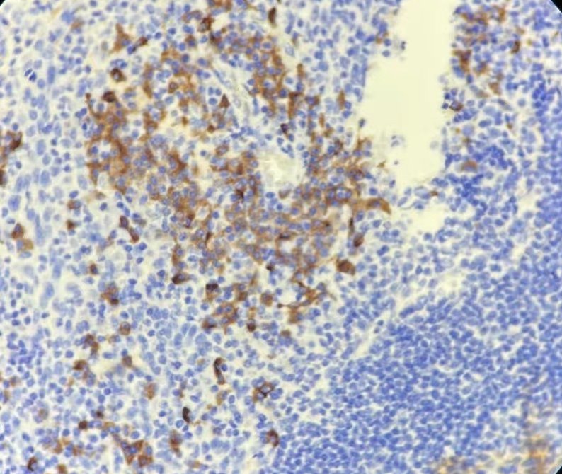 Marquage immunohistochimique anti-IgG — Dartmon