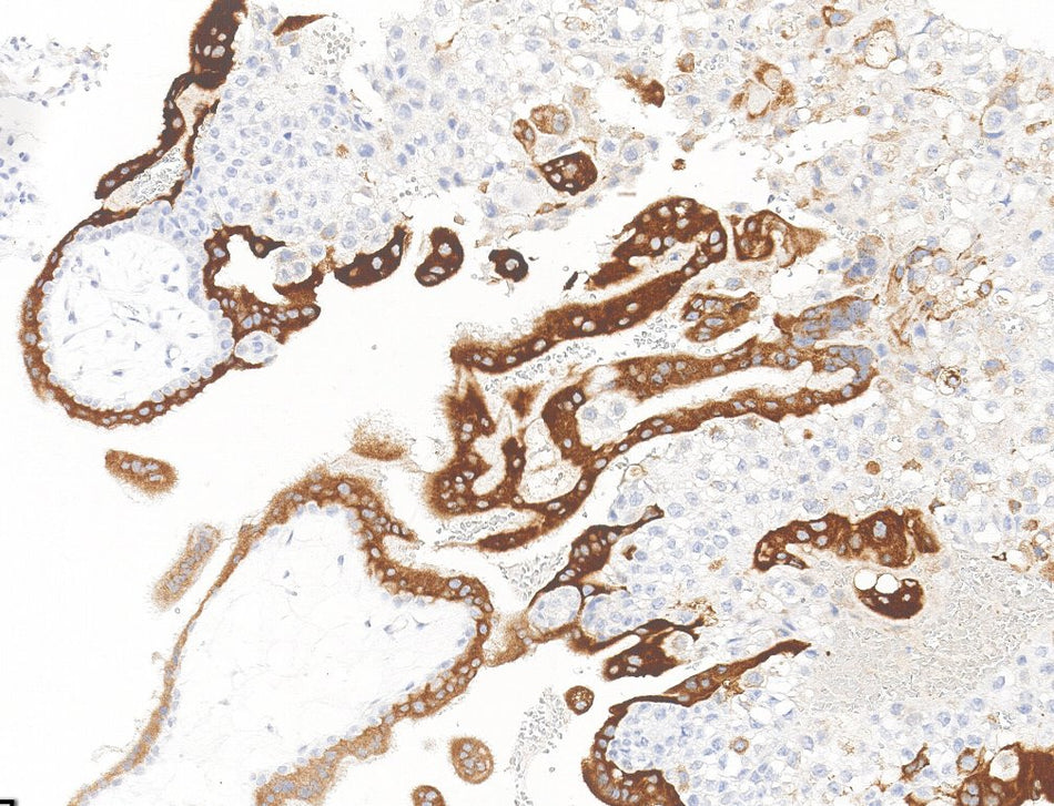 Marquage immunohistochimique anti-INHA — Dartmon