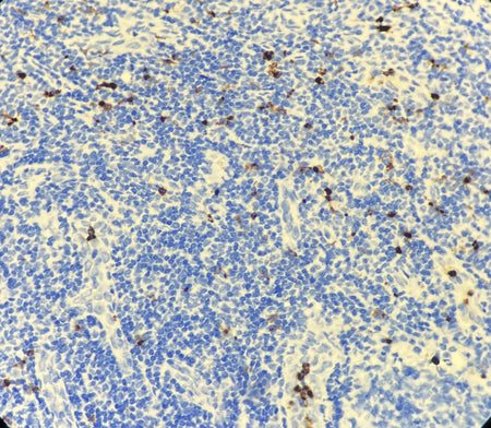Marquage immunohistochimique anti-Myéloperoxydase — Dartmon