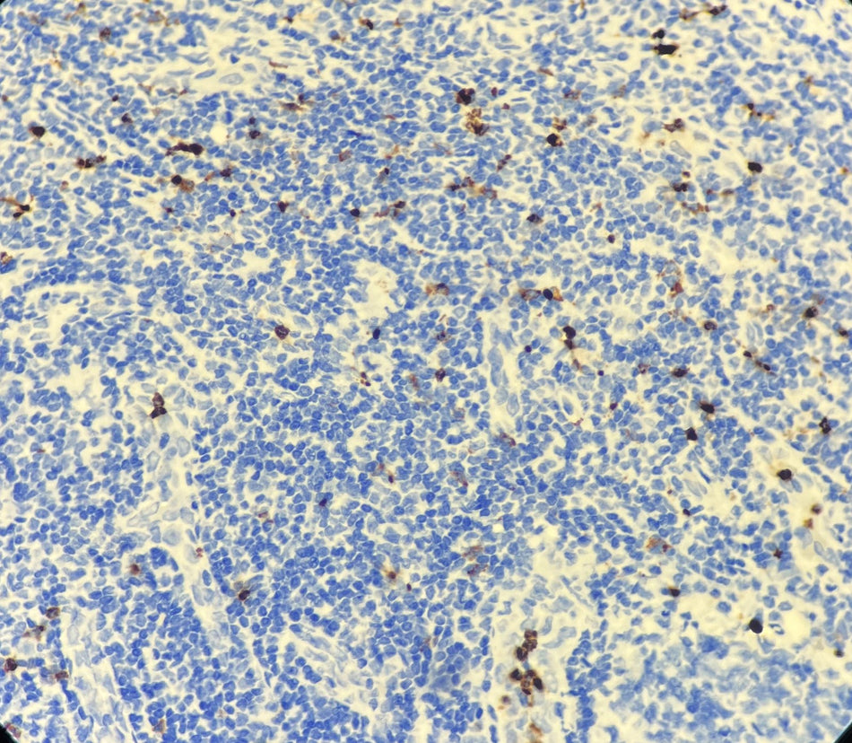 Marquage immunohistochimique anti-Myéloperoxydase — Dartmon