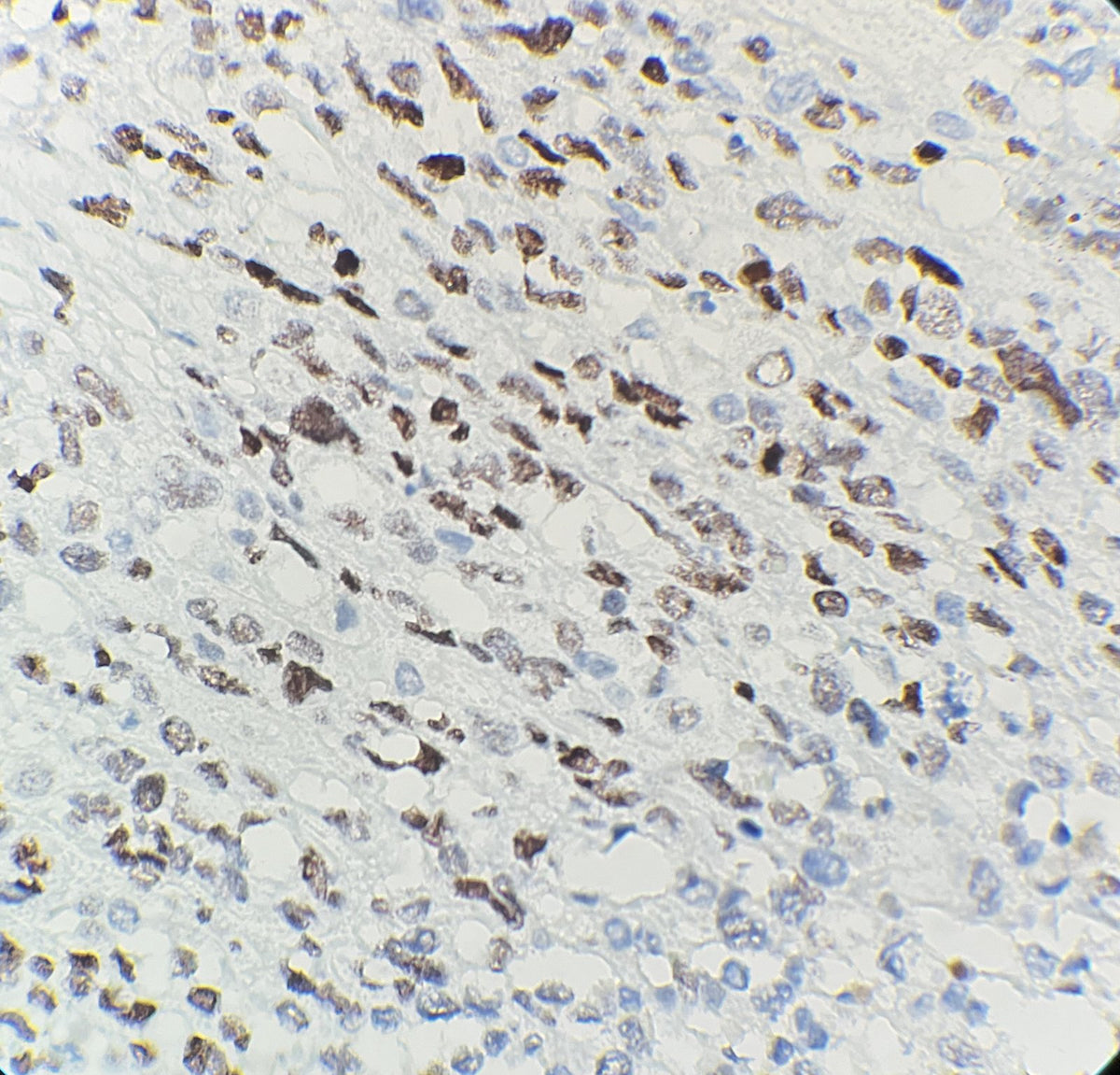 Marquage immunohistochimique anti-Myo D1 — Dartmon