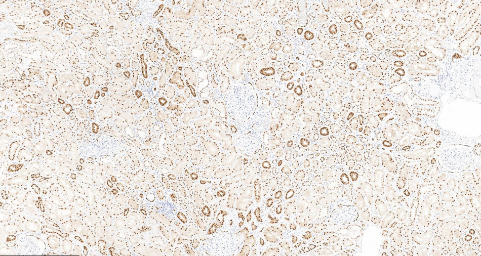 Marquage immunohistochimique anti-Pax-8 — Dartmon