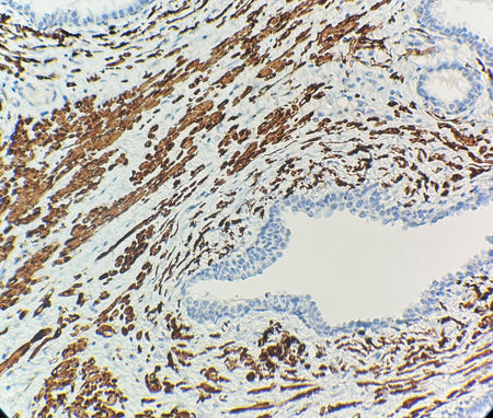 Marquage immunohistochimique anti-Calponin — Dartmon