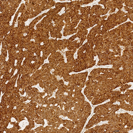Marquage immunohistochimique anti-CGA — Dartmon