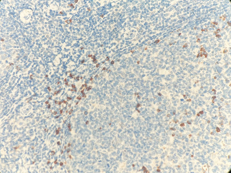 Marquage immunohistochimique anti-Chaîne légère kappa — Dartmon