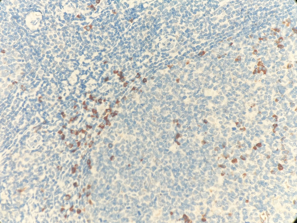 Marquage immunohistochimique anti-Chaîne légère kappa — Dartmon