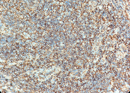 Marquage immunohistochimique anti-CD99 — Dartmon