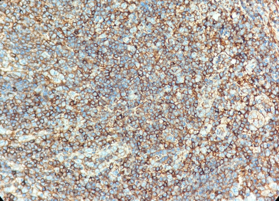 Marquage immunohistochimique anti-CD99 — Dartmon