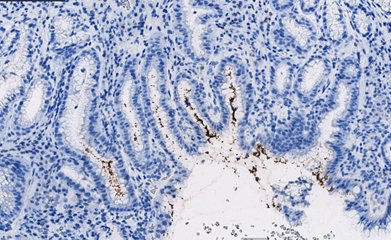 Marquage immunohistochimique anti-Helicobacter pylori — Dartmon