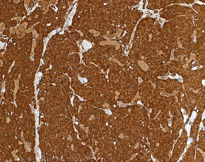 Marquage immunohistochimique anti-CT — Dartmon