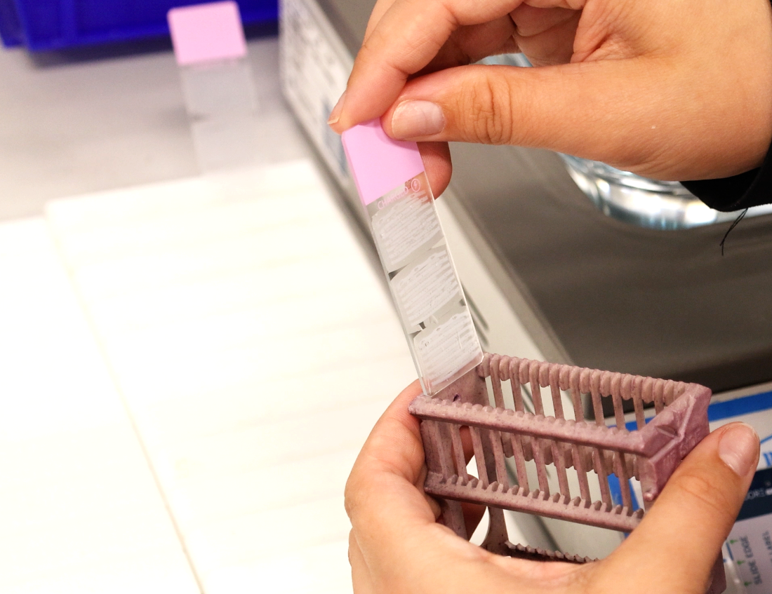 Lames d'histologie placées dans un portoir