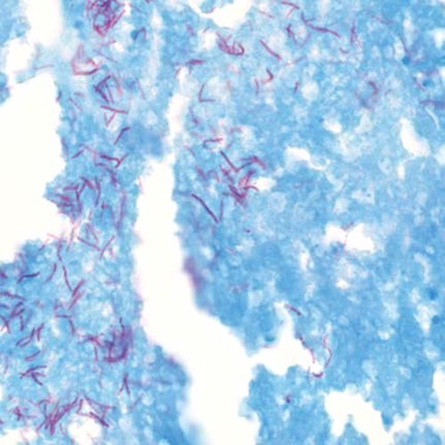 Kit TB-Stain Histo