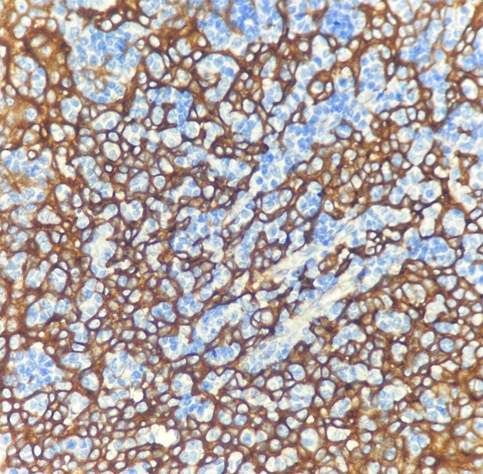 EGFR (DA054)