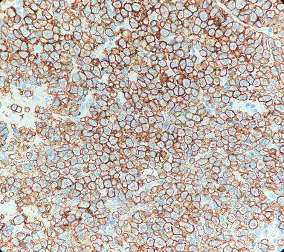 CD138