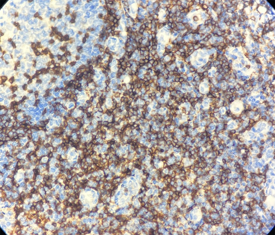 CD3 (DA024)