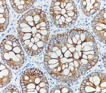 Charger l'image dans la galerie, CK19 (DA043)
