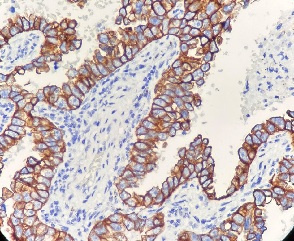 CK7 (DA046)