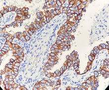 Charger l'image dans la galerie, CK7 (DA046)
