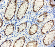 Charger l'image dans la galerie, CDX-2 (DA035)
