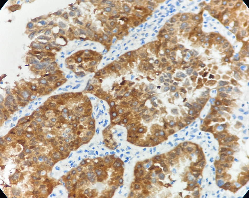 CDK4 (DA133)
