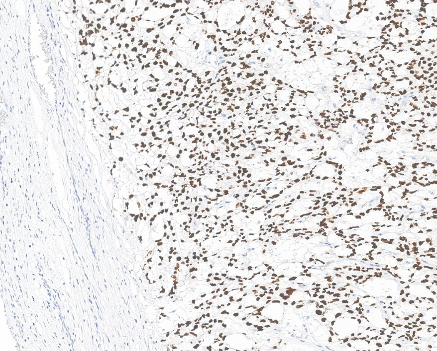 SALL4 (DA106)