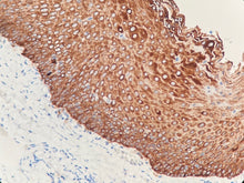 Charger l'image dans la galerie, CK (haut poids moléculaire) (DA039)
